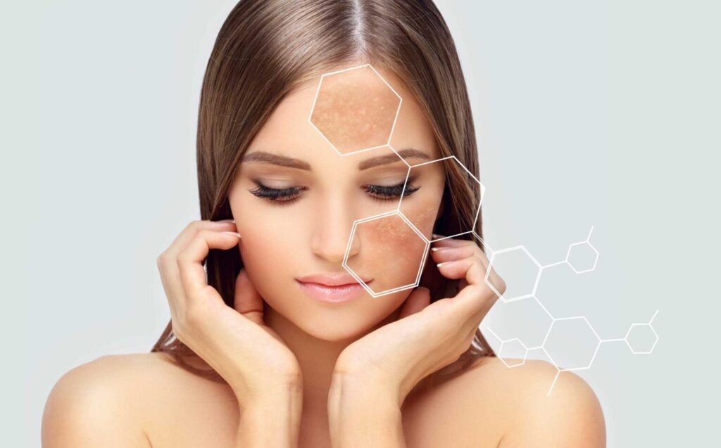 झाइयों से छुटकारा पाने के 7 घरेलू उपाय (pigmentation होगी खत्म, बढ़ेगा face glow.) 12 पिगमेंटेशन