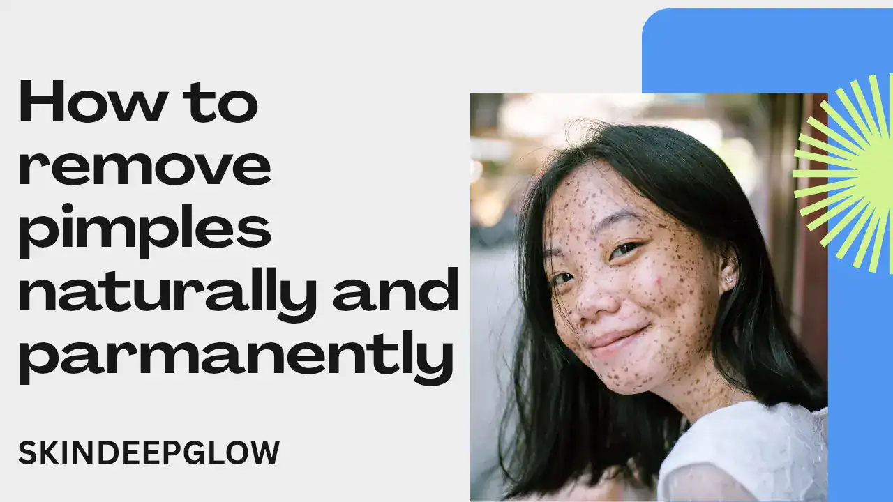 Read more about the article How to Remove Pimples Naturally and Permanently! पिंपल्स हटाने के घरेलू असरदार उपाय (2025)