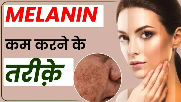 Read more about the article “How to Reduce Melanin in Skin Naturally: सिर्फ 7 दिनों में पाएं साफ, निखरी और ग्लोइंग त्वचा (2025 गाइड)”