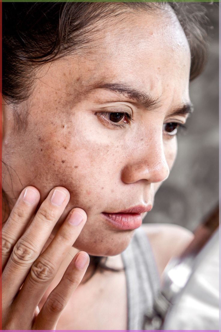 be80ed338e7c3221d179f9c24a4f904e