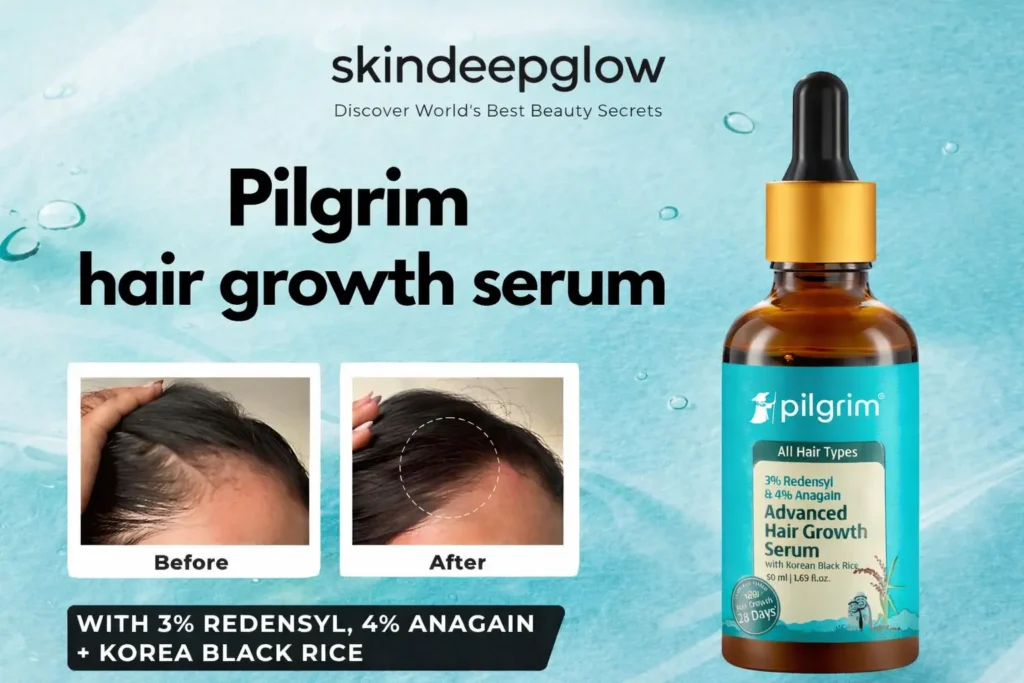 Pilgrim hair growth serum thumbnail showing before and after hairline results with 3% Redensyl and 4% Anagain, branded by Skindeepglow for blog use