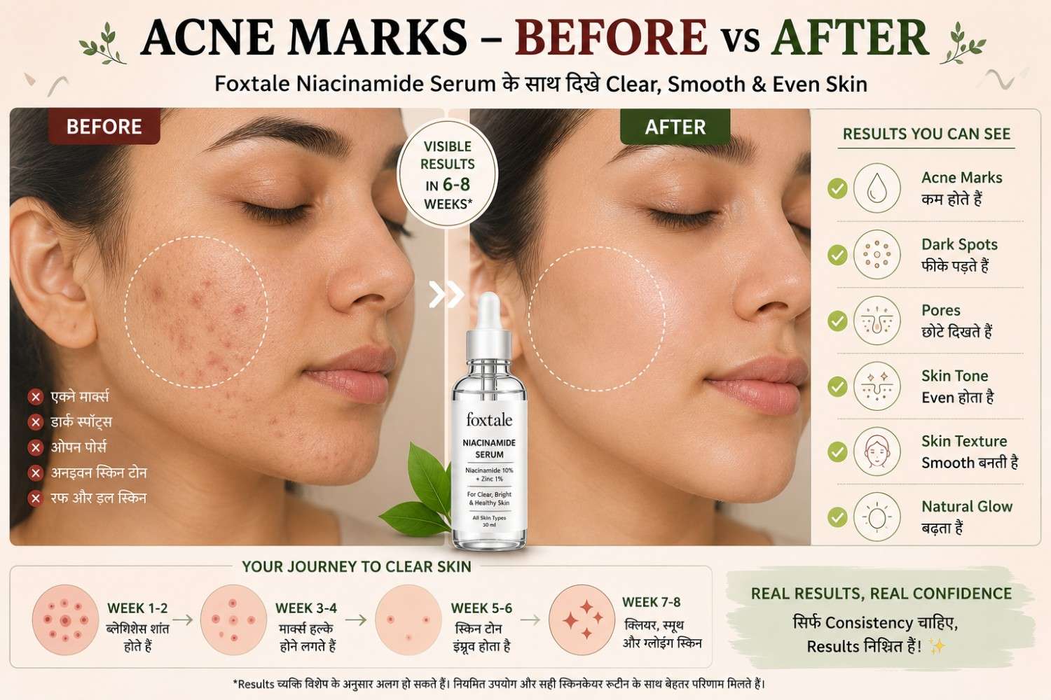 Dermatologist Recommended HOCl Spray for Acne and Sensitive Skin