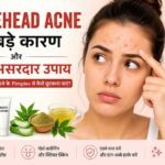 forehead ance ke karan