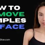 How to Remove Pimples
