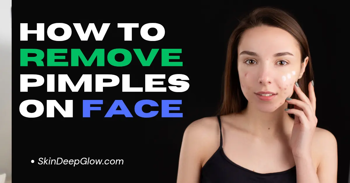 How to Remove Pimples