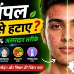 पिंपल कैसे हटाए