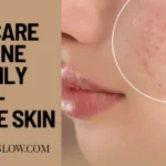 Skincare routine for oily acne prone skin india