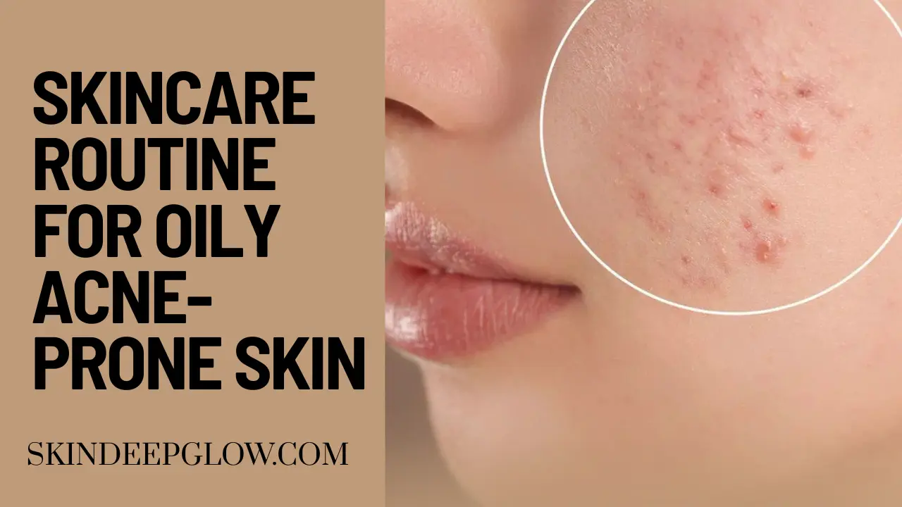Skincare routine for oily acne prone skin india
