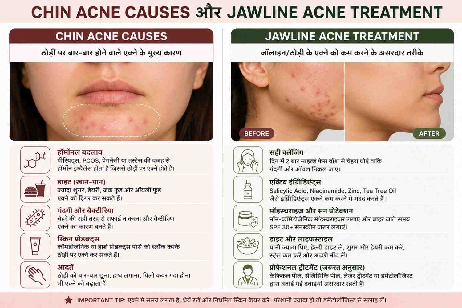 Chin acne causes and treatment