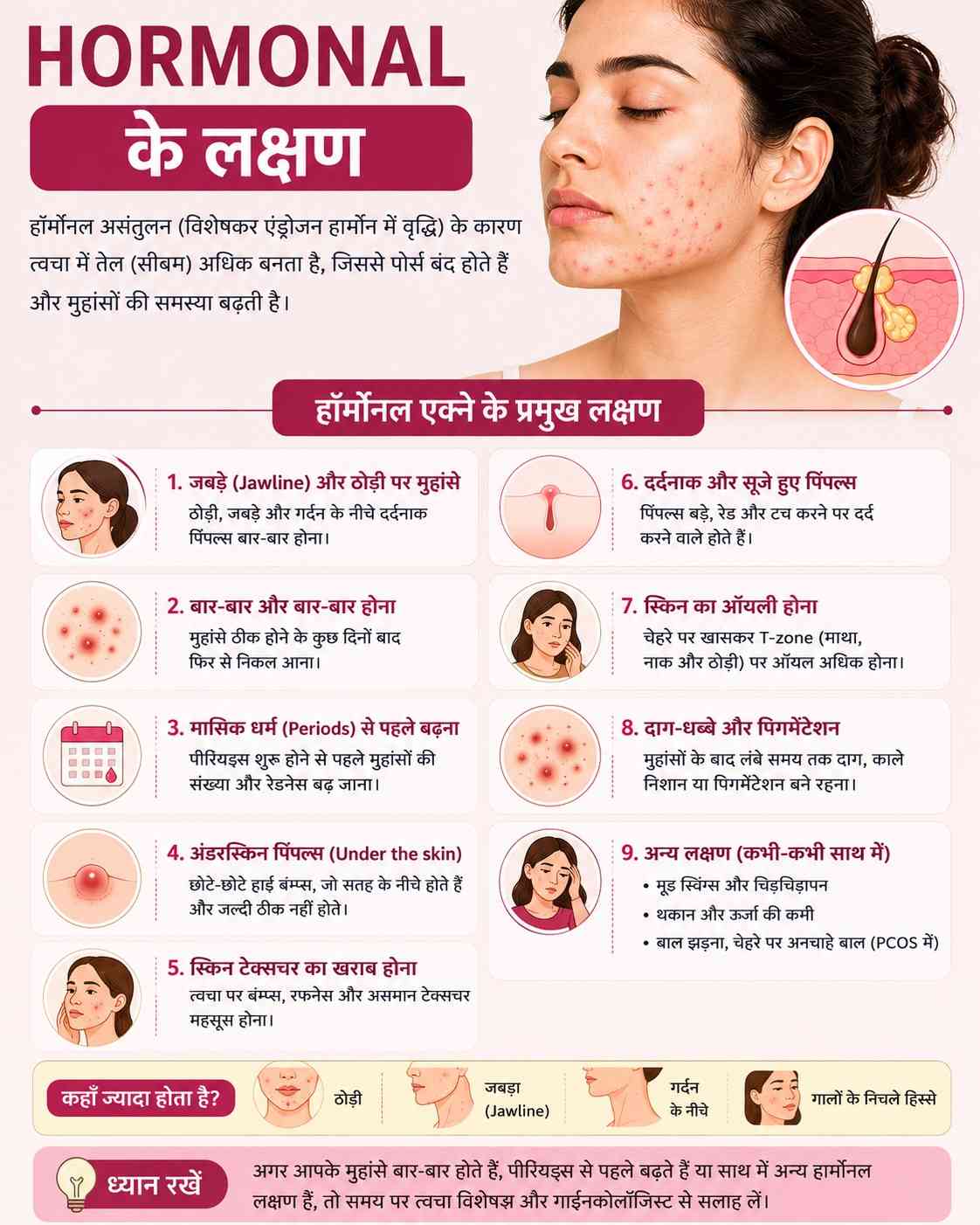 Hormonal acne symptoms