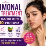 hormonal acne treatment hindi.webp
