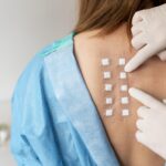 Patch Test for Skin Allergy