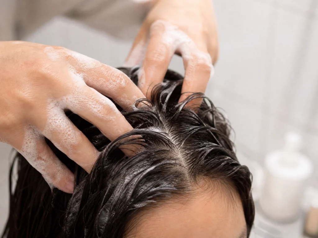 Stop Scrubbing! How to Get Rid of Dandruff by Doing Less (My 4-Week Protocol) 4 applying anti-dandruff shampoo to scalp